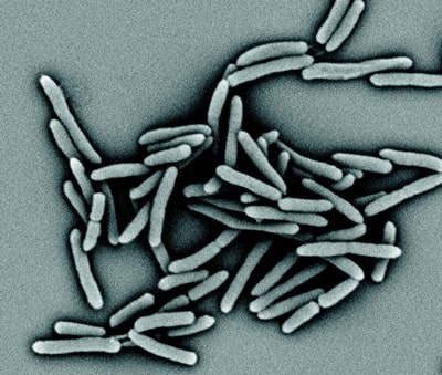 Scanning electron micrograph of the tuberculosis pathogen M.tuberculosis